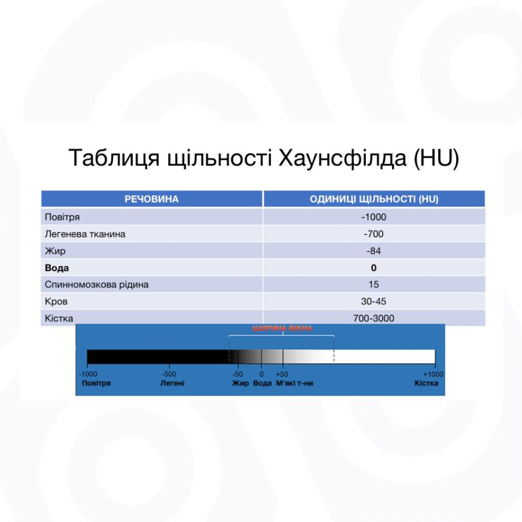 Чому вікна КТ - важлива складова якісної діагностики | МЦ "Євроклінік"