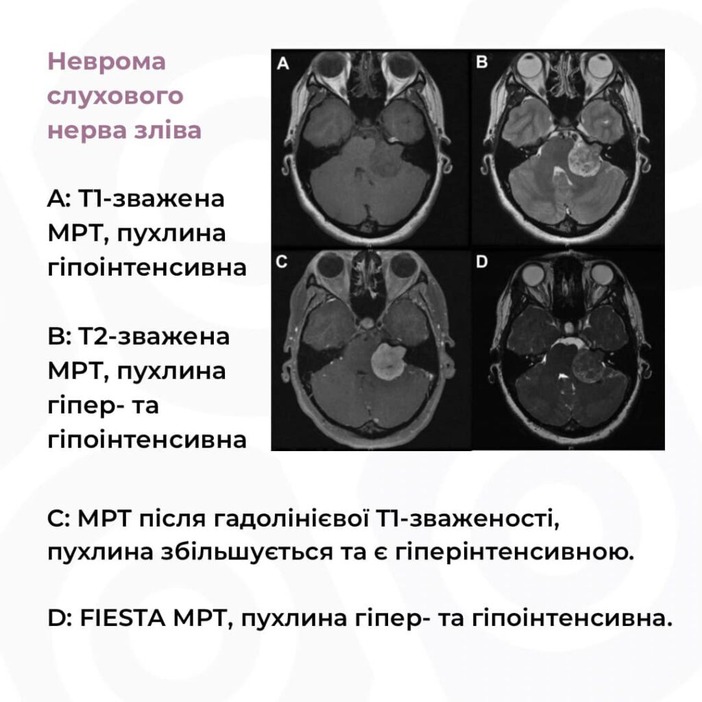 FIESTA | МЦ Євроклінік