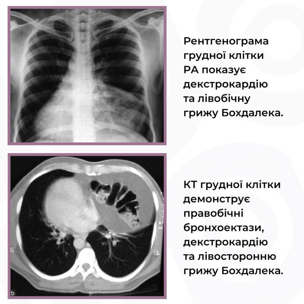 Дзеркальне розташування органів | "Євроклінік"