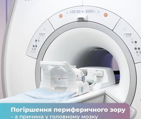 Погіршення периферичного зору, а його причина — у головному мозку 🧠