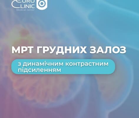МРТ грудних залоз із динамічним контрастним підсиленням у «Євроклінік» ✅