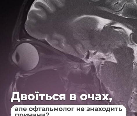 Двоїться в очах, але офтальмолог не знаходить причини? У таких випадках може бути рекомендоване МРТ головного мозку