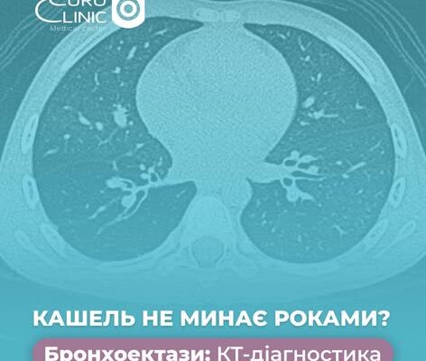 Кашель не минає роками? Це серйозна проблема, що потребує діагностики