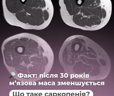 Факт: після 30 років мʼязова маса зменшується
