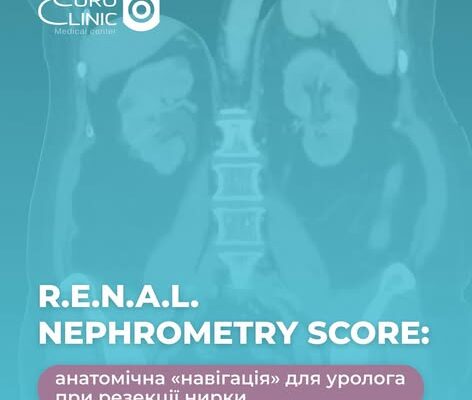 R.E.N.A.L. Nephrometry Score: анатомічна «навігація» для уролога при резекції нирки